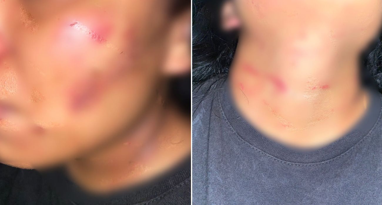 Detienen a hombre por intentar asfixiar a su esposa 