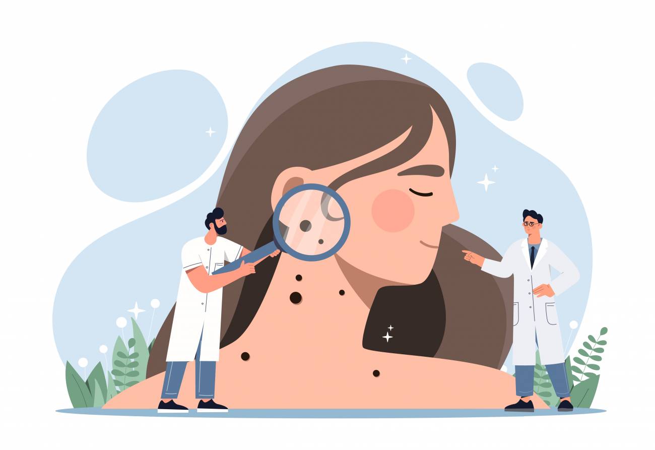 El-cancer-de-piel-entra-en-una-nueva-era-de-prevencion-y-diagnostico-precoz.jpg