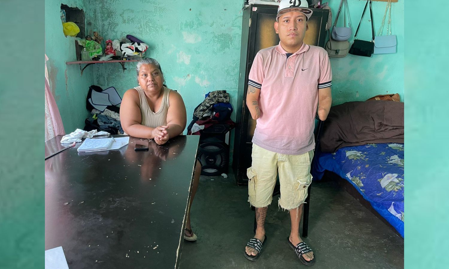 le-amputan-manos-pero-deseo-de-salir-adelante