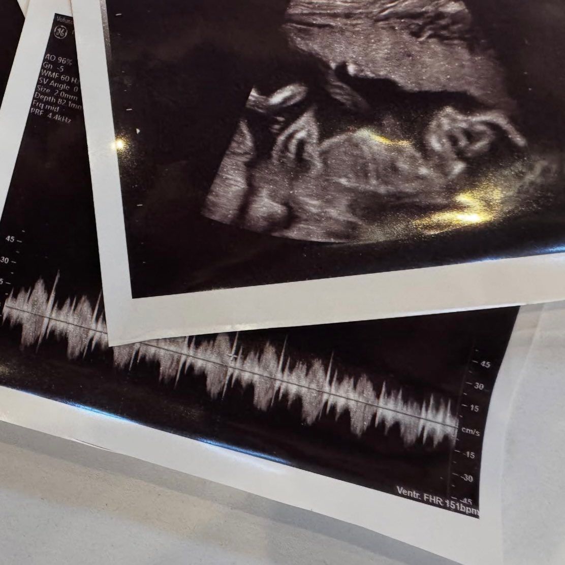 G0SZTndXUAA1asm.jfif