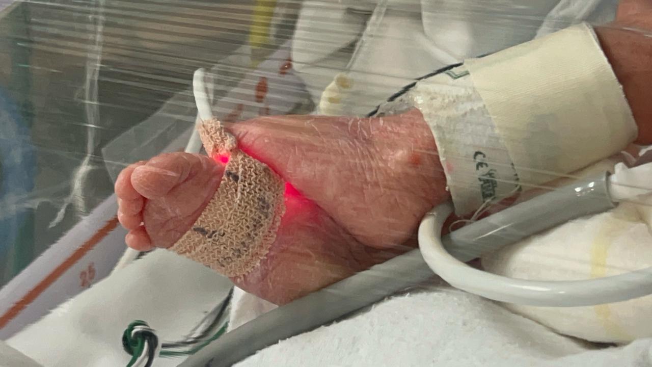Joven madre da a luz a trillizos en hospital materno infantil