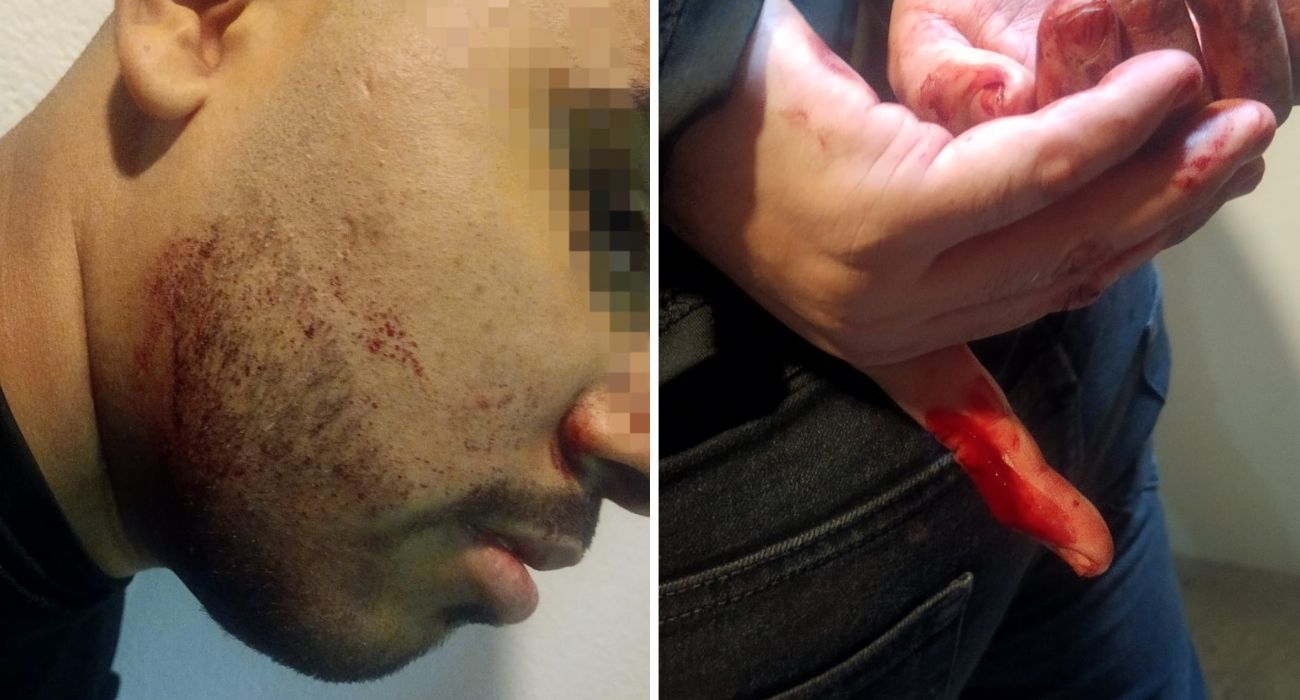Muere hombre tras ataque en su casa; hay un detenido