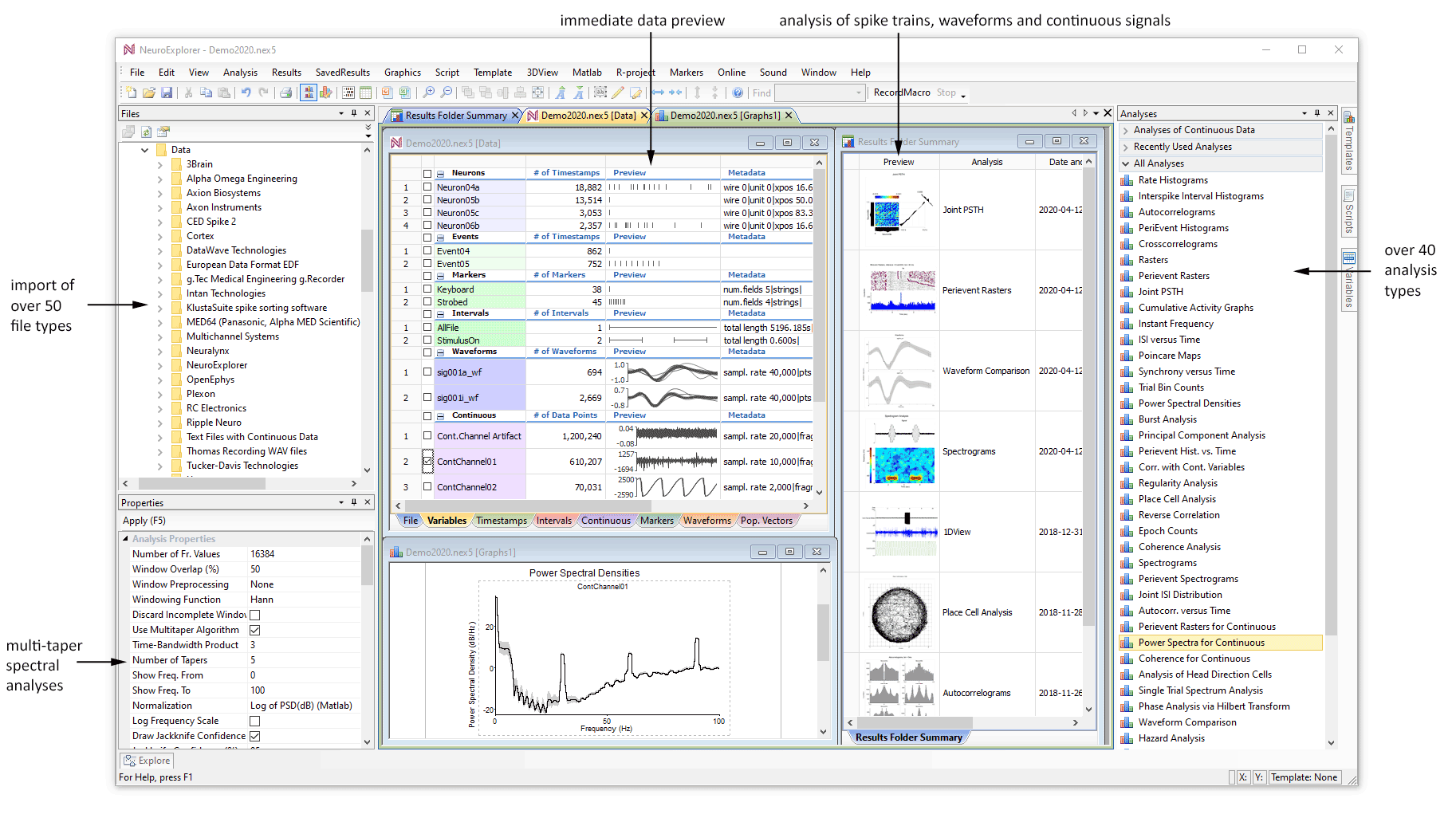 NeuroExplorer analiza datos importa más de 50 datos escáner cerebral.png