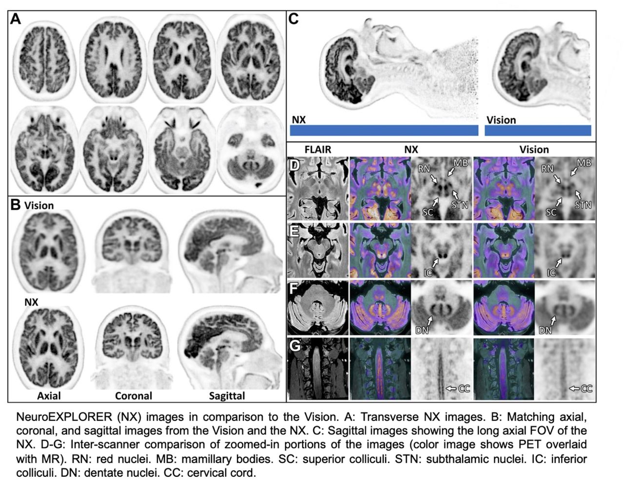 NeuroExplorer áreas del cerebro pueden observarse con mayor detalle.jpg
