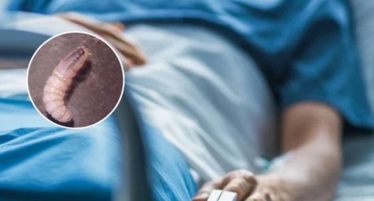 Suman cuatro casos por gusano barrenador en humanos en Chiapas