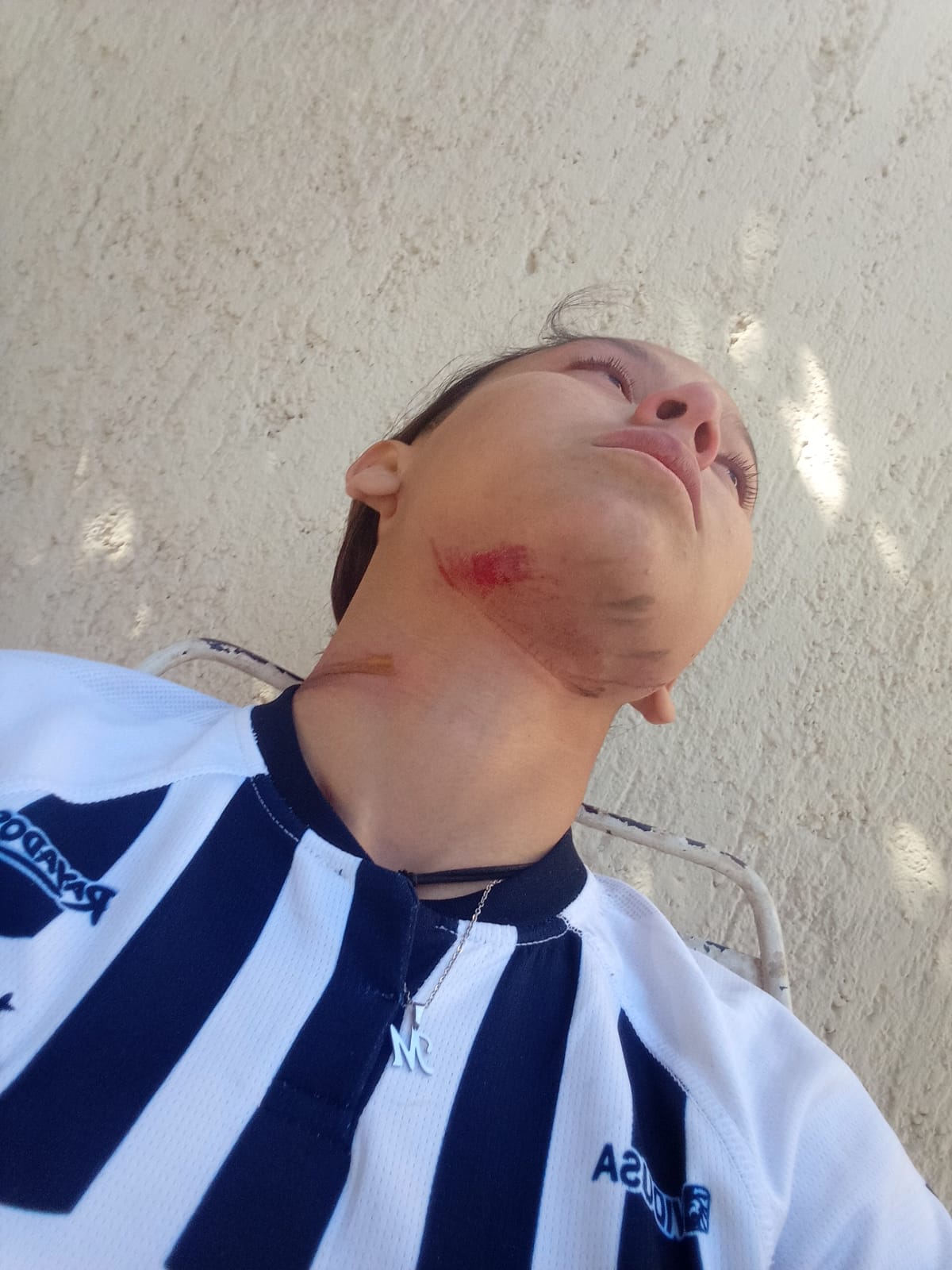 cables-colgados-tiran-a-universitaria-de-su-moto