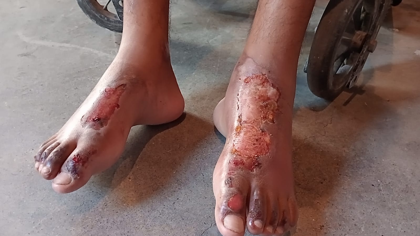 WhatsApp Image 2025-08-11 at 5.32.29 PM.jpeg