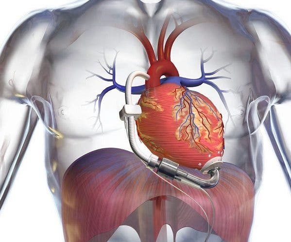 fallecimientos-enfermedades-cardiovasculares.jpg