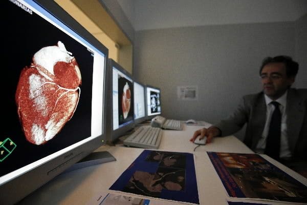 fallecimientos-enfermedades-cardiovasculares.jpg
