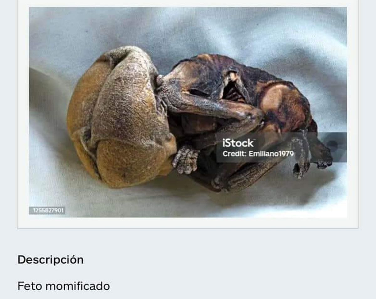 feto-momificado.jpg