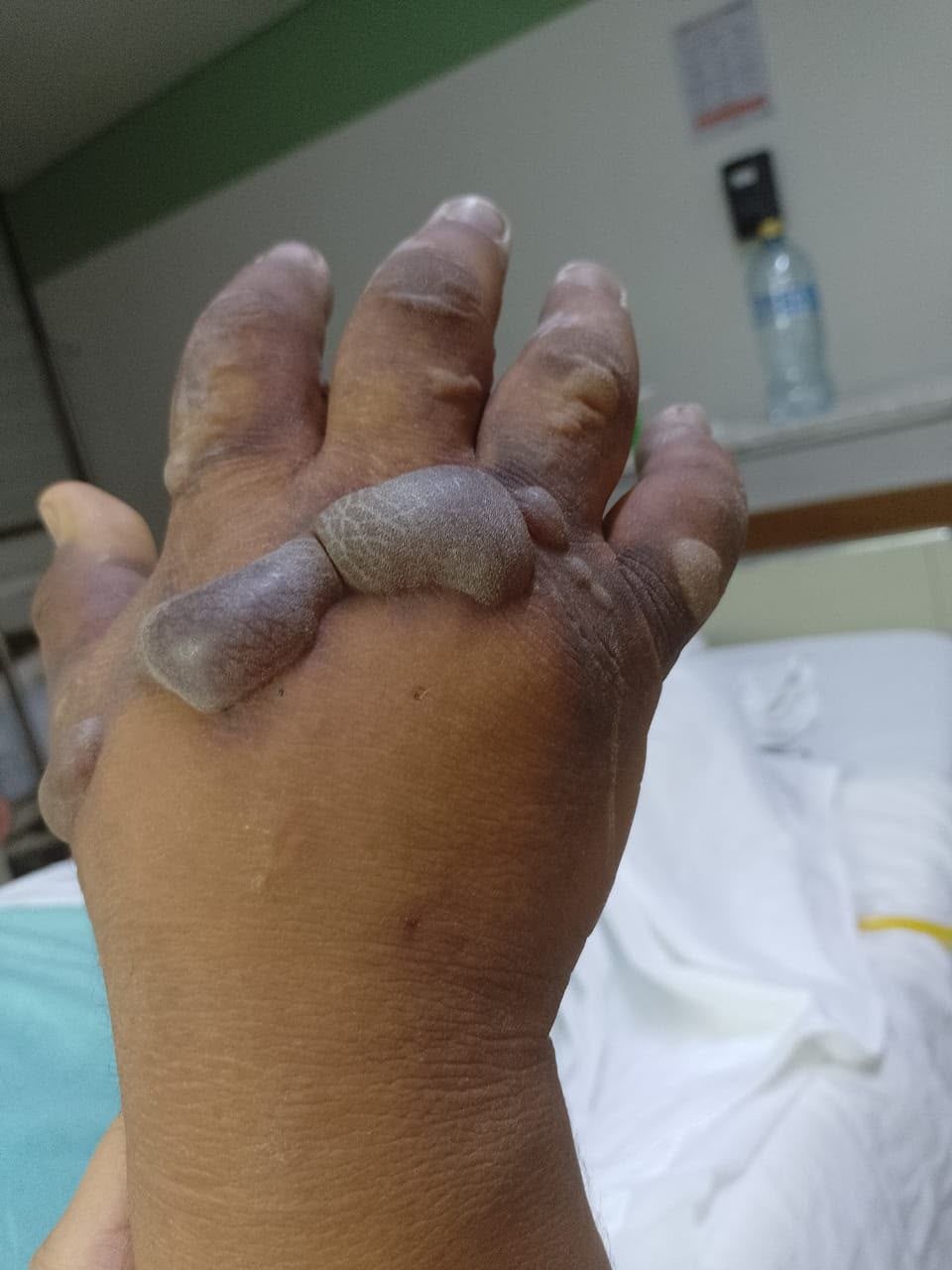 mano_negligencia.jpeg
