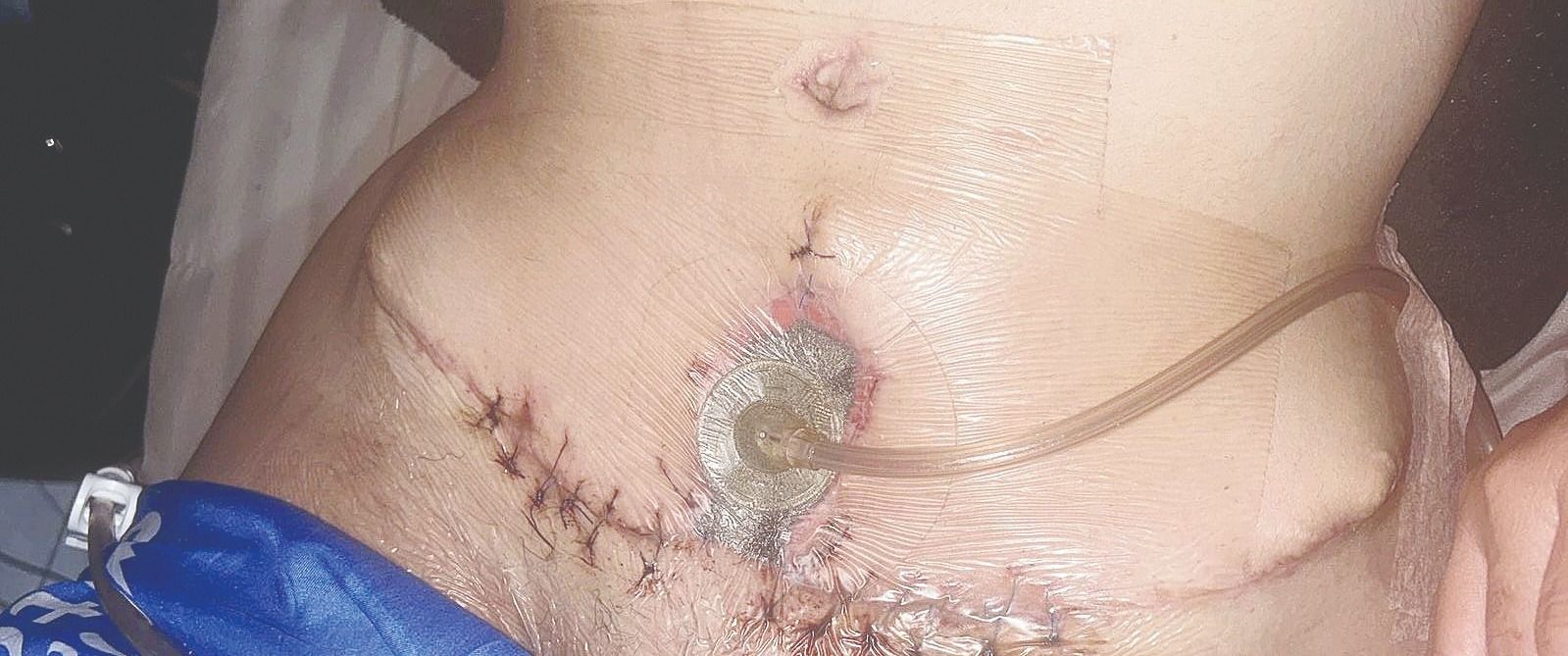 nl-regia-cirugia-fallida-1 (2).jpg