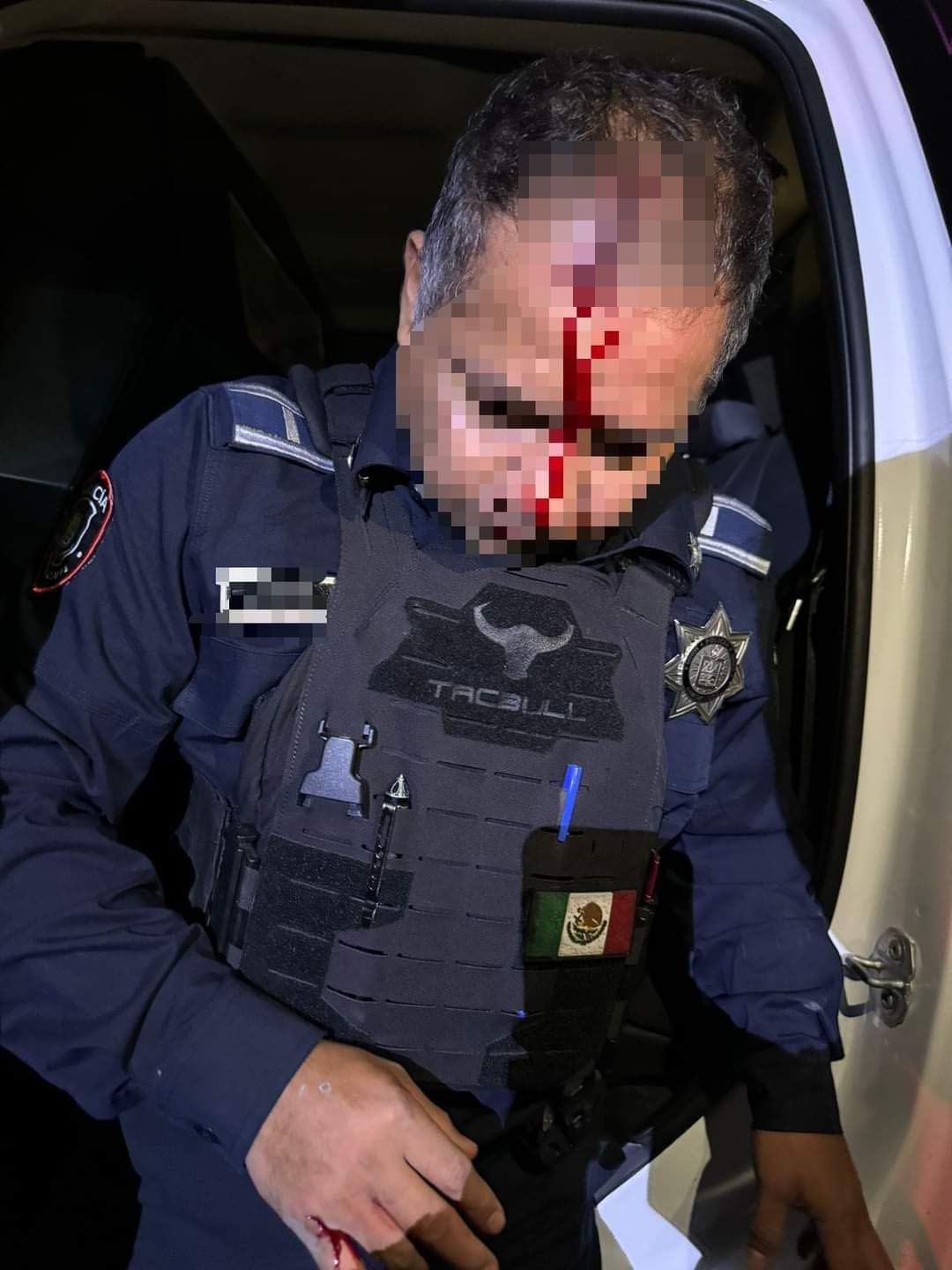 policia-guadalupe-lesionado-ok.jpg