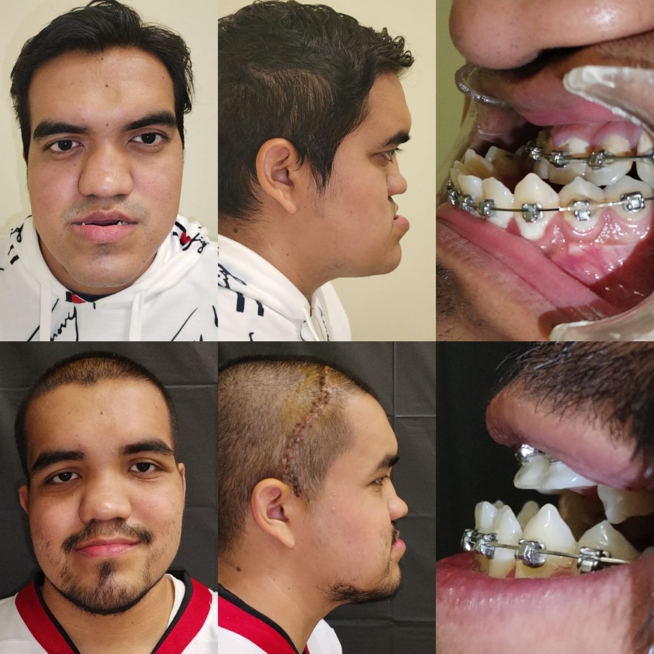 rostro-imss-cirugia4.JPG