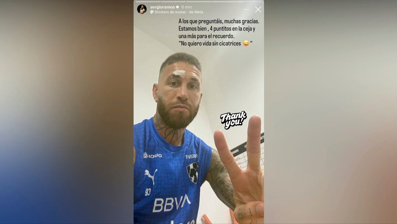 sergio-ramos-herida-cabeza.jpg
