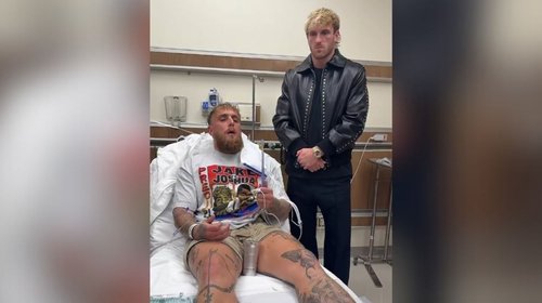 ¡Qué paliza! Jake Paul termina con doble fractura de mandíbula