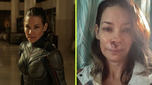 Evangeline Lilly revela daño cerebral tras accidente en Hawái