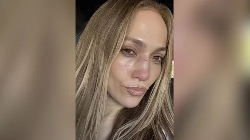Jennifer Lopez compartió su percance en ensayos de los AMAs