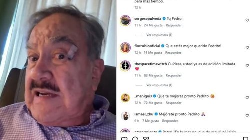 Pedro Sola aclara su estado de salud tras ausencia
