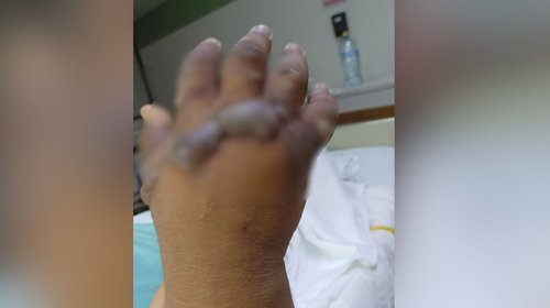 Joven arriesga una mano; familia acusa negligencia del IMSS