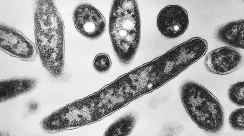 Muertes por legionelosis en Nueva York suben a 6; 111 infecciones