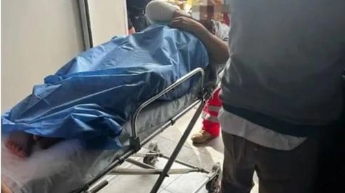 Explosión de pirotecnia deja cuatro mujeres lesionadas en desfile
