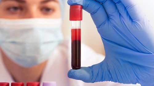 Avanza detección temprana del cáncer vía sanguínea