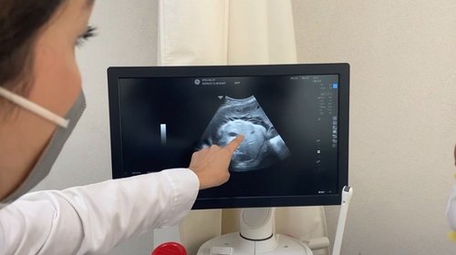 IMSS estatal protege la salud de 7,000 embarazadas