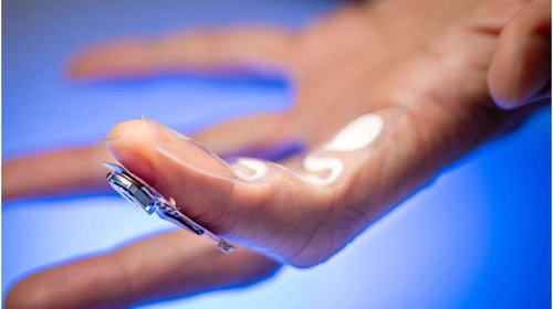 Crean parche que optimiza el tratamiento del Parkinson