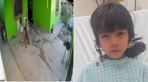 Video: Ataca perro a niña en vivienda de Frontera, Coahuila