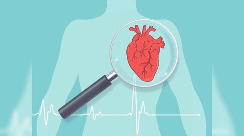 Científicos estudian el síndrome del corazón en vacaciones