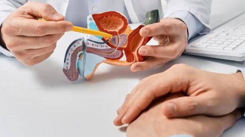 Cofepris autoriza molécula nueva para tratar cáncer de próstata