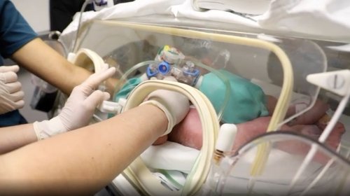 Separan a siamesas nacidas en el hospital Materno Infantil