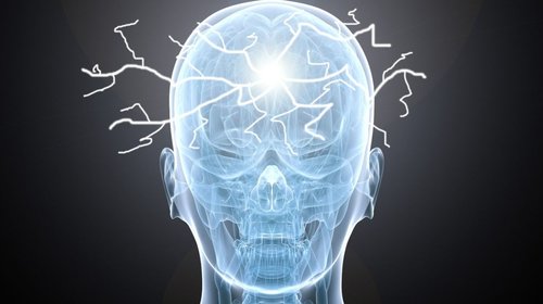 Hoy es el Día Internacional de la Epilepsia; trastorno crónico