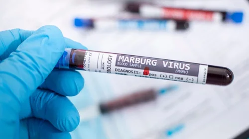 OMS reporta brote de virus de Marburgo en Tanzania: ocho muertos
