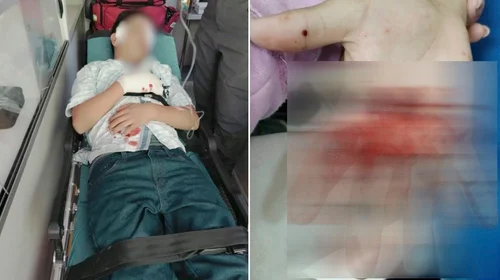 Explota cohete en la mano a menor en fraccionamiento de Saltillo