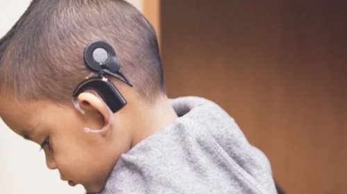 Suprema Corte ordena al IMSS dar prótesis y lentes a menores