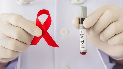 Aumentan contagios de VIH en México; van 12 mil en nueve meses
